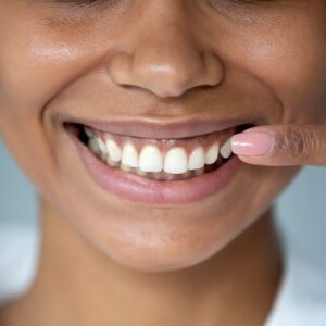 tooth-colored fillings dentist near me